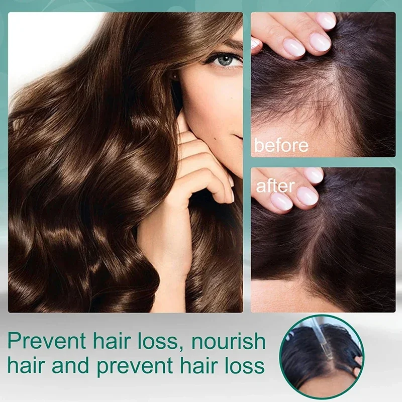 Behandlung Flüssigkeit vier Kr – Hair Care Natural Ingredients Bewertung und Preis